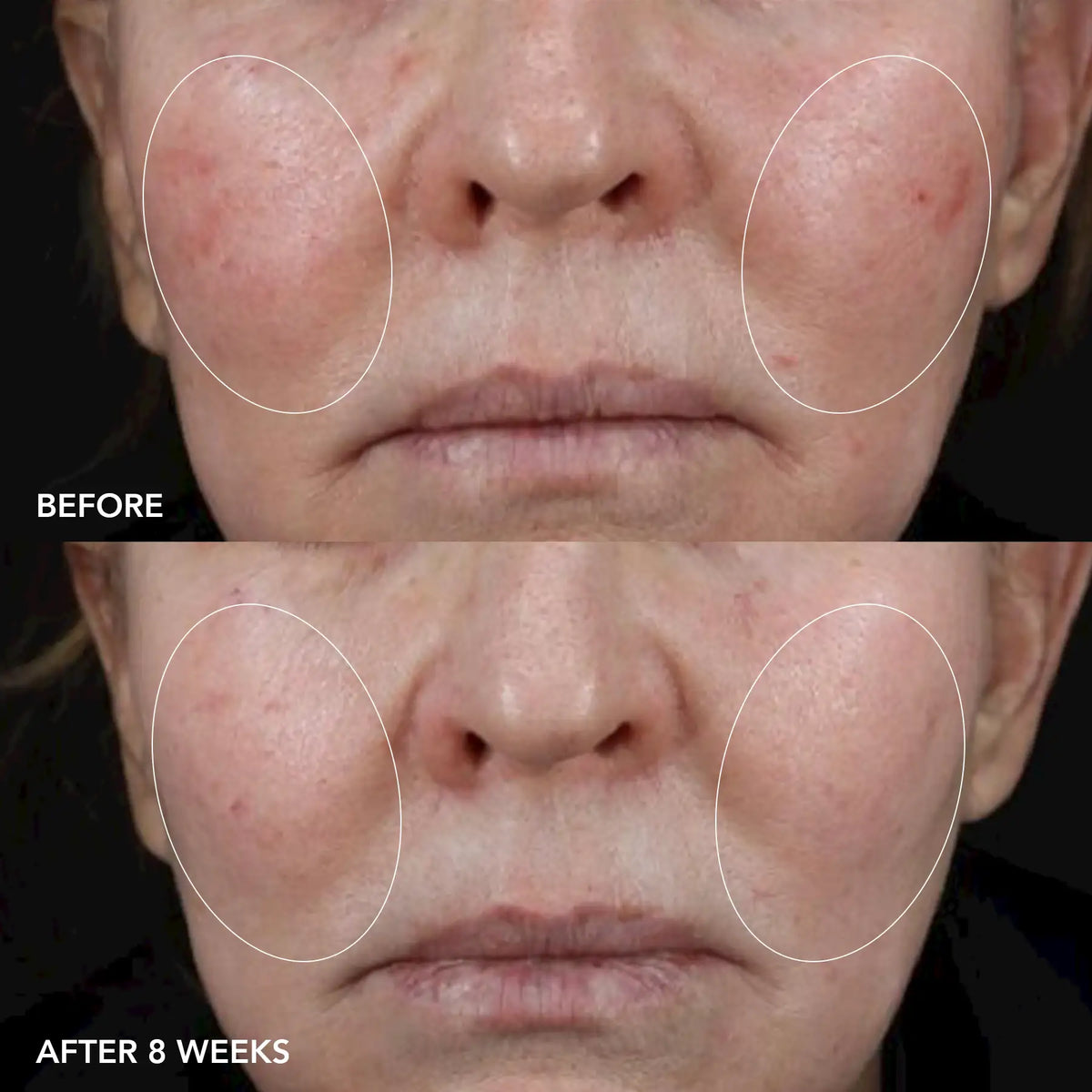 IMAGE Skincare MD Biotech Longevity Crème before and after 8 weeks of use