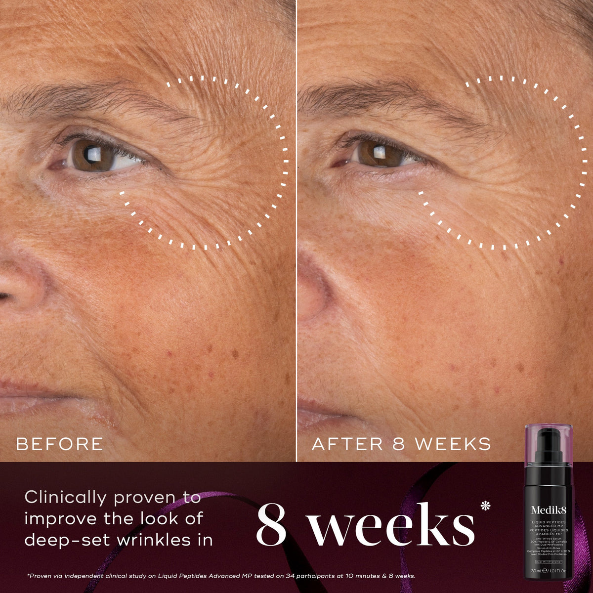 Medik8 Firm Favourites Liquid Peptides Advanced MP before and after results at 8 weeks
