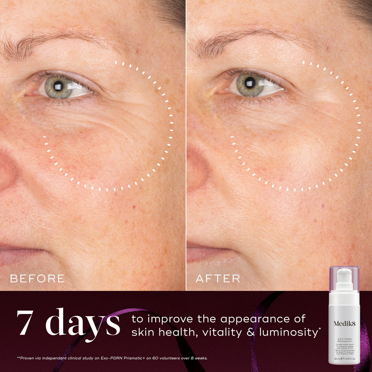 Medik8 Firm Favourites Exo-PDRN Prismatic+ before and after luminosity results at 7 days