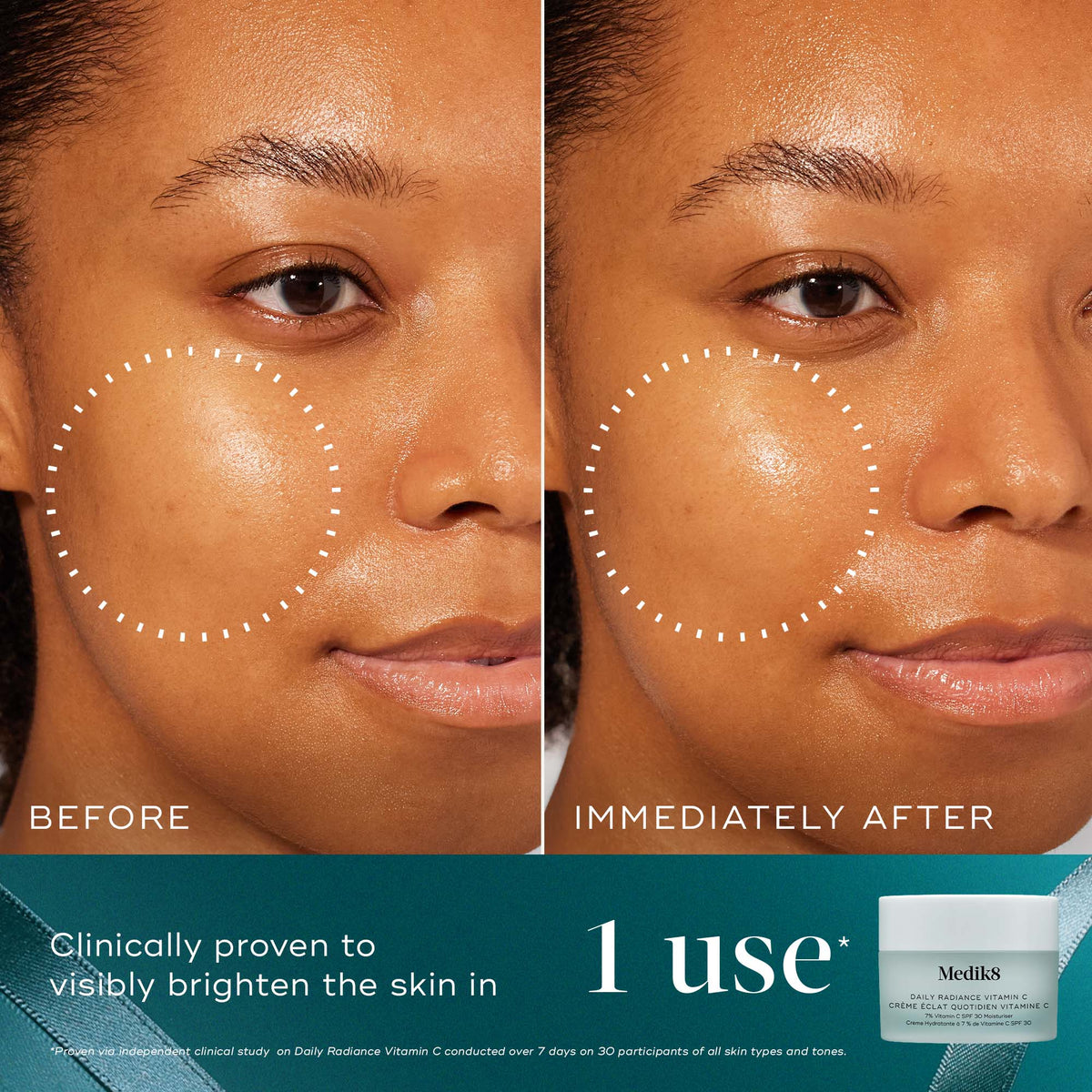 Medik8 Moisture Minis Daily Radiance Vitamin C before and after brightening results