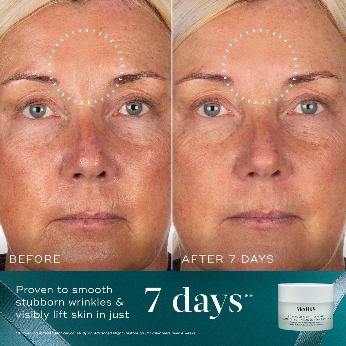 Medik8 Moisture Minis Advanced Night Restore before and after results at 7 days