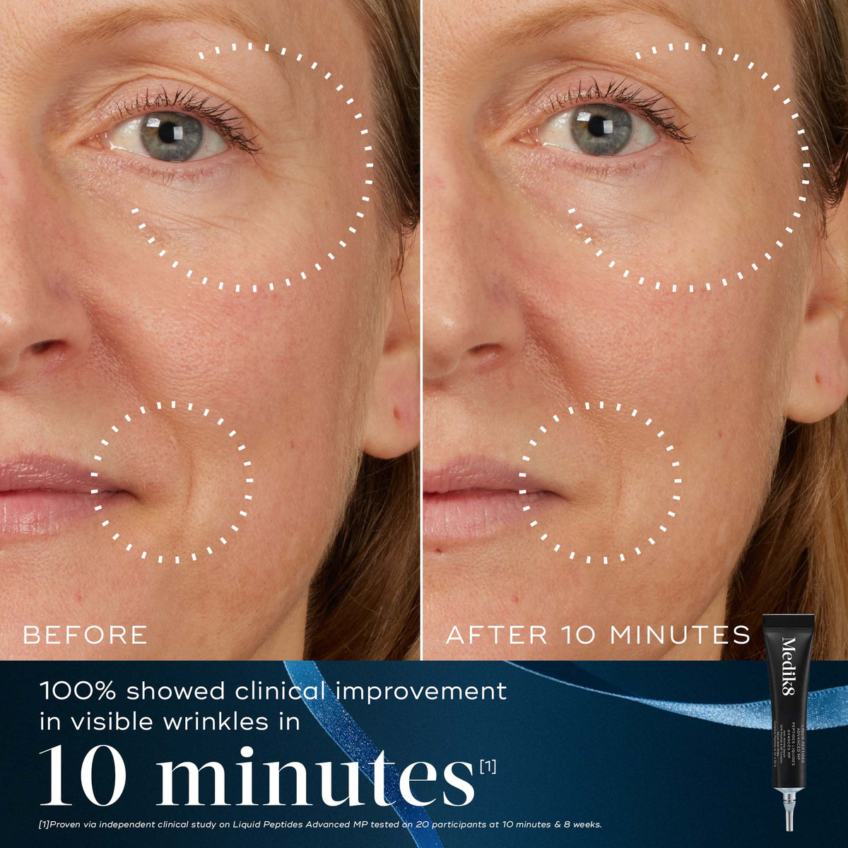 Medik8 Age-Defying Essentials Liquid Peptides Advanced MP before and after at 10 minutes