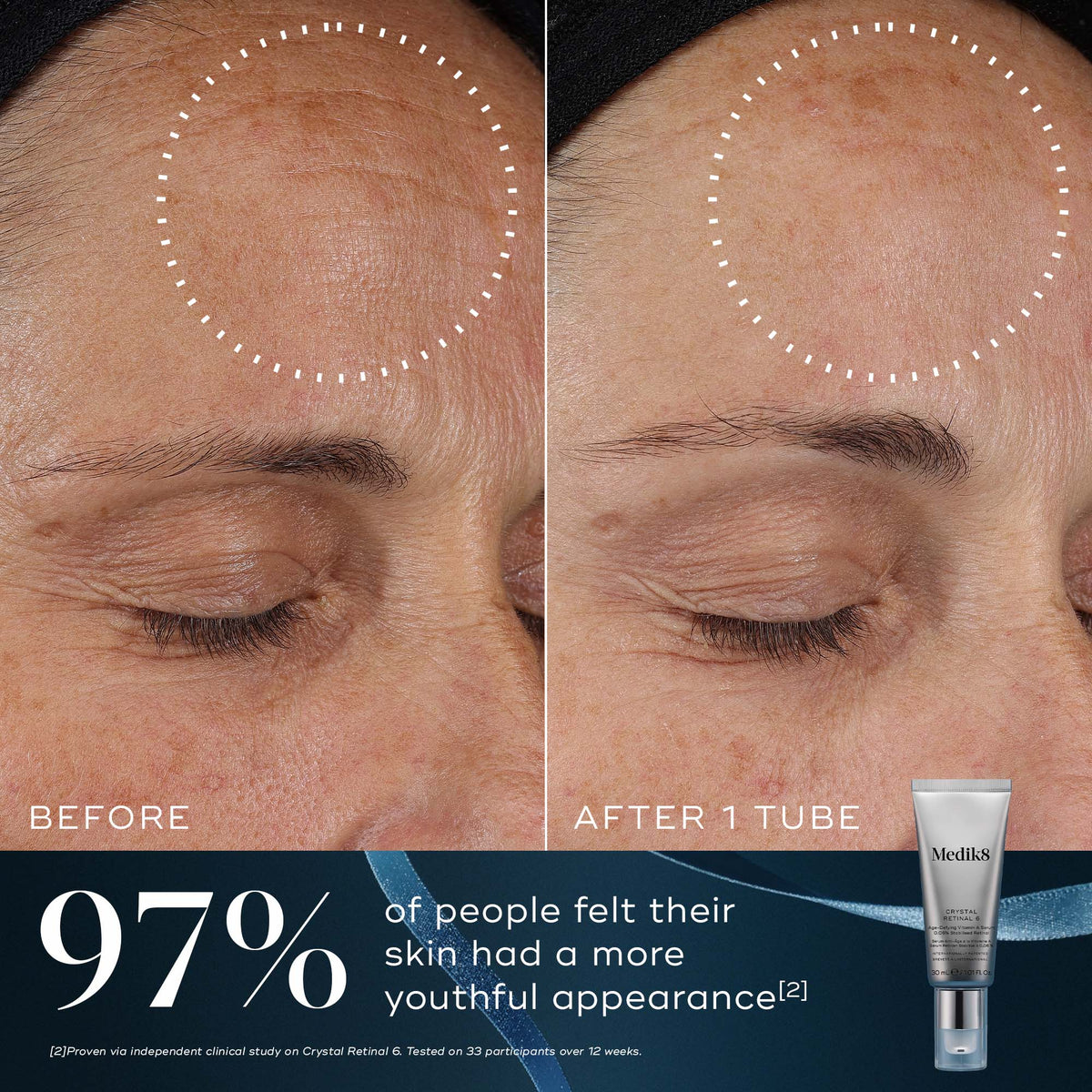 Medik8 Age-Defying Essentials Crystal Retinal 6 before and after results