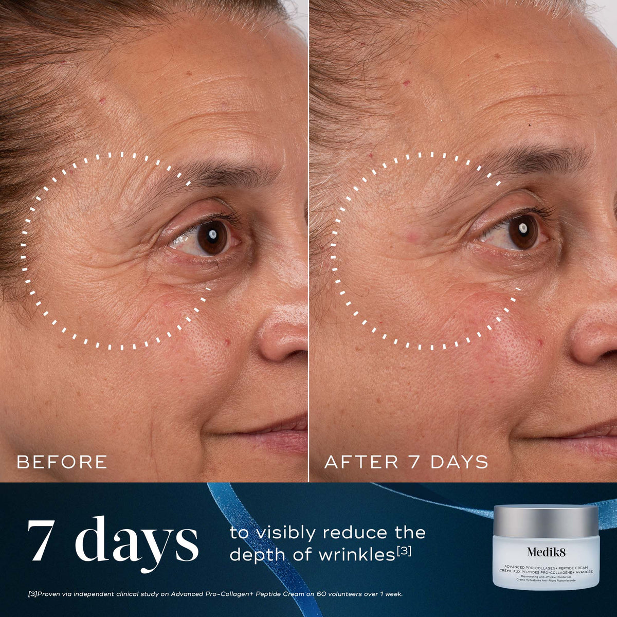 Medik8 Age-Defying Essentials Advanced Pro-Collagen+ Peptide Cream before and after at 7 days