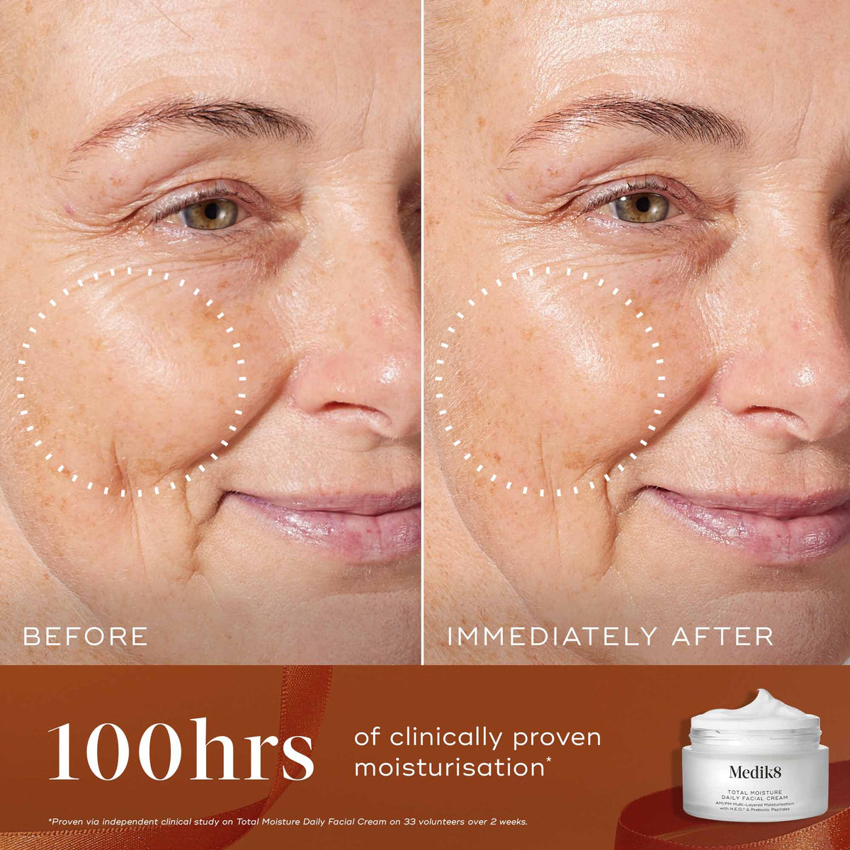 Medik8 Radiance Ritual Total Moisture Daily Facial Cream before and after hydration results