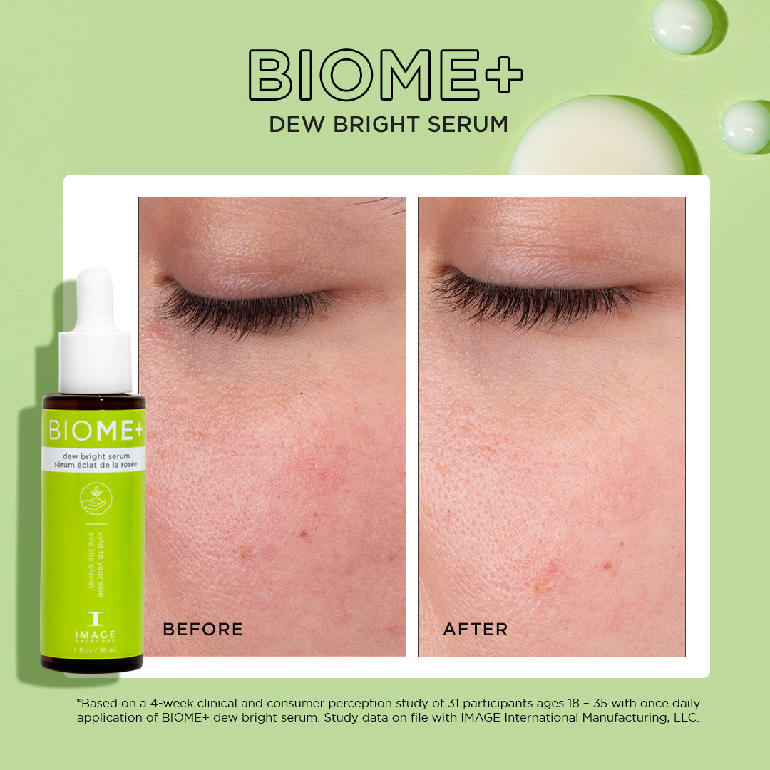 IMAGE Skincare BIOME+ Dew Bright Serum before and after 4 weeks of daily use