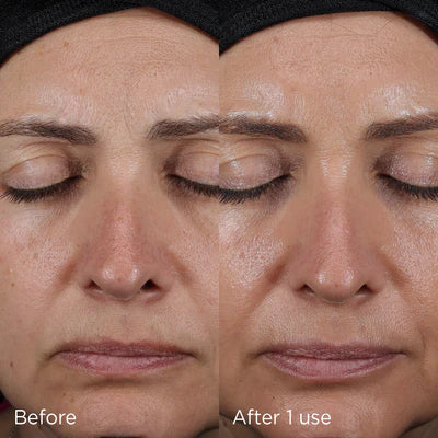 IMAGE Skincare DAILY PREVENTION Advanced Smartblend Mineral Moisturiser SPF 50+ before and after one use on the face