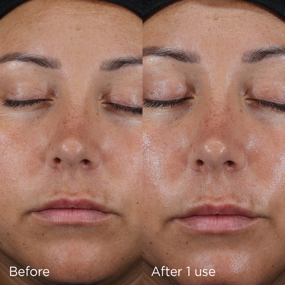 IMAGE Skincare DAILY PREVENTION Ultra Defence Moisturiser SPF 50 before and after one use on the face