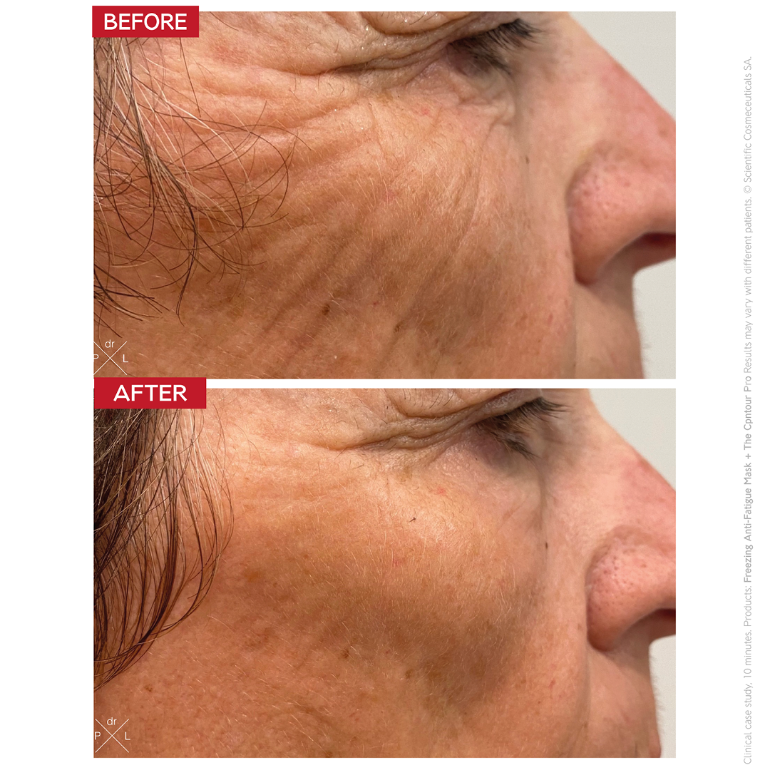 Dr LEVY Contour Pro product detail 5