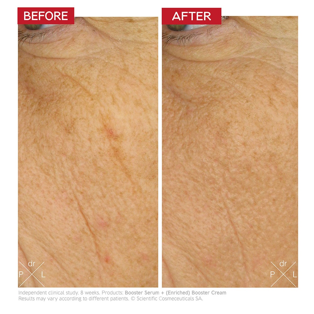 Dr LEVY Enriched Booster Cream before and after results