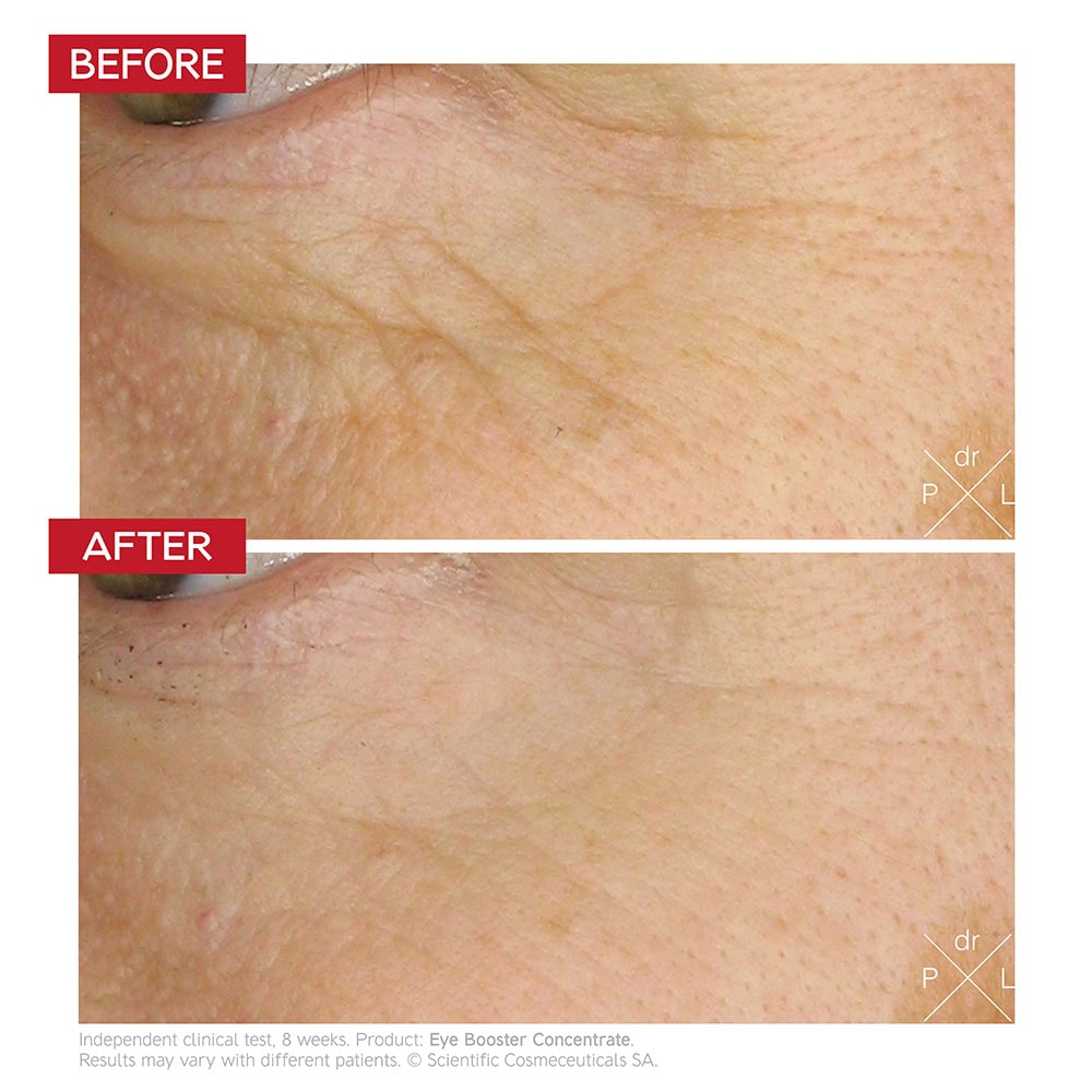 Dr LEVY Eye Booster Concentrate before and after results