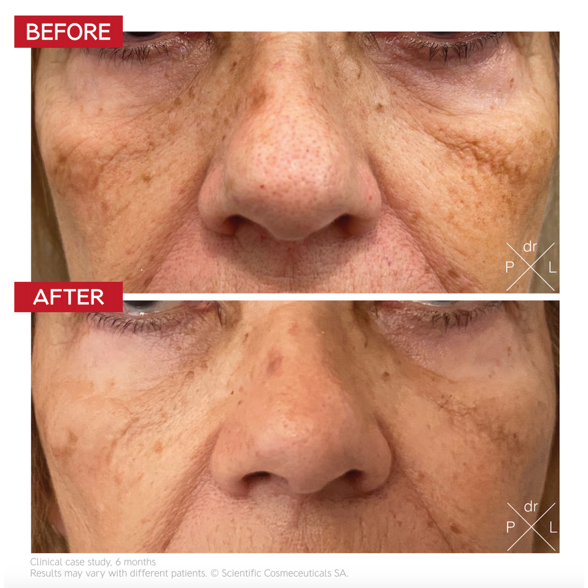 Dr LEVY Pigment Control Drops product detail 4