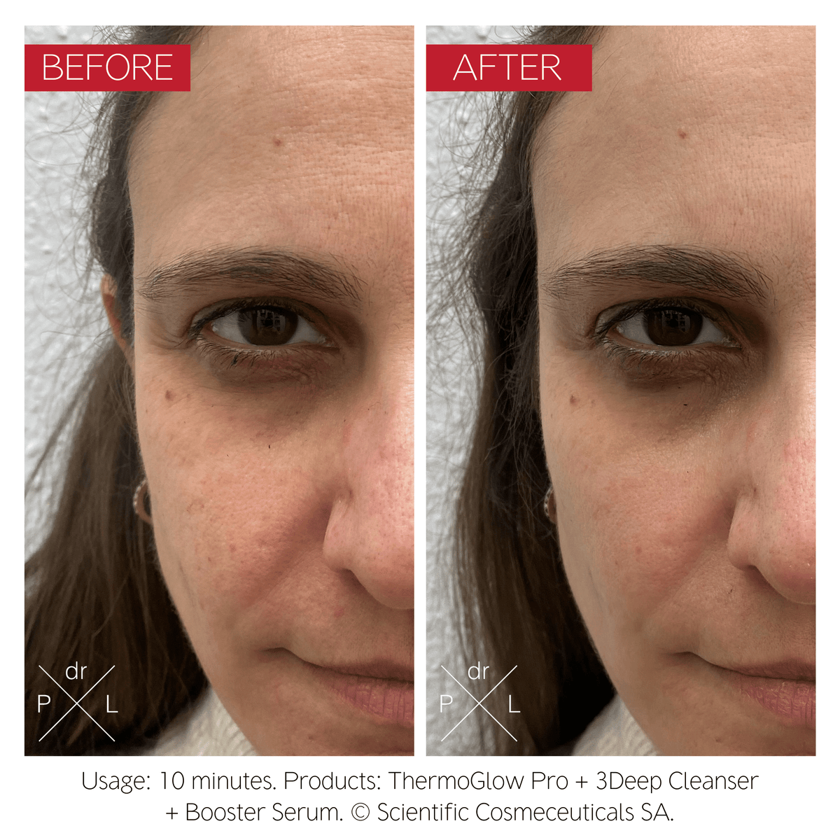 Dr LEVY ThermoGlow Pro product detail 4