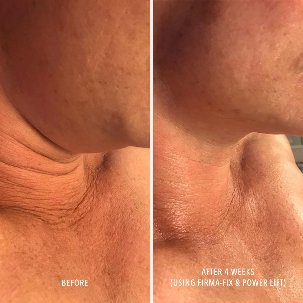 HydroPeptide Firm-A-Fix Nectar before and after on the neck