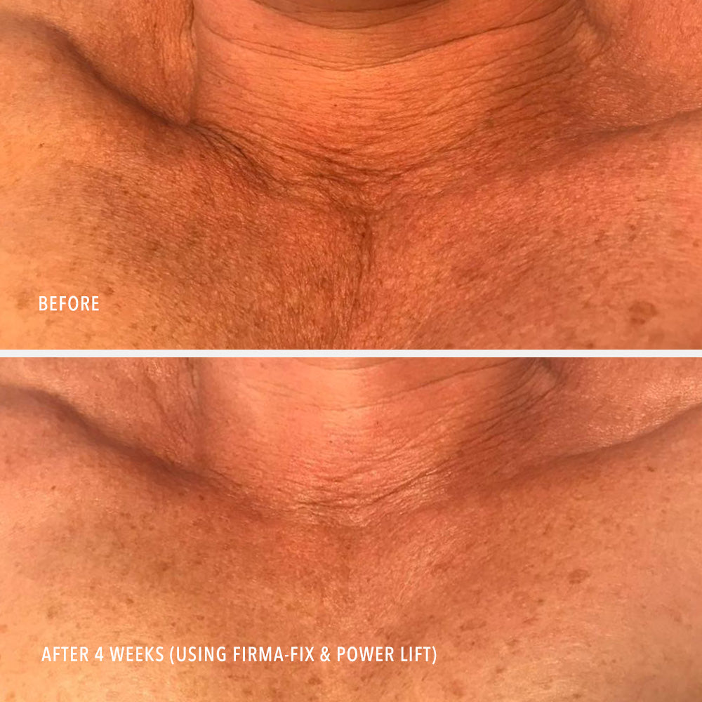 HydroPeptide Firm-A-Fix Nectar before and after firmer-looking neck