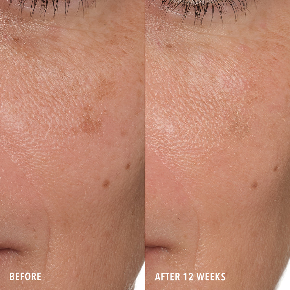 HydroPeptide Syner-C+ before and after showing brighter, more even-looking skin