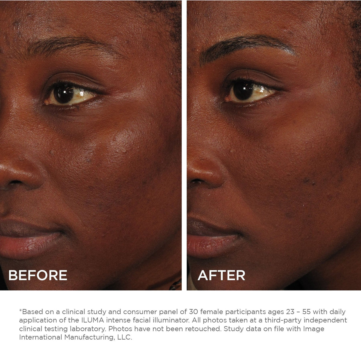 IMAGE Skincare ILUMA Intense Facial Illuminator before and after 12 weeks of daily use