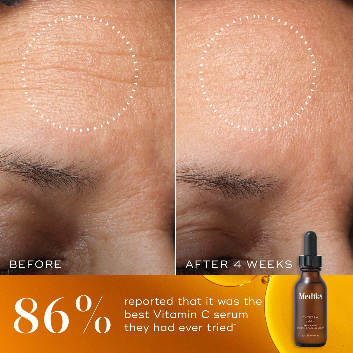 Medik8 C-Tetra Luxe Travel Size before and after results