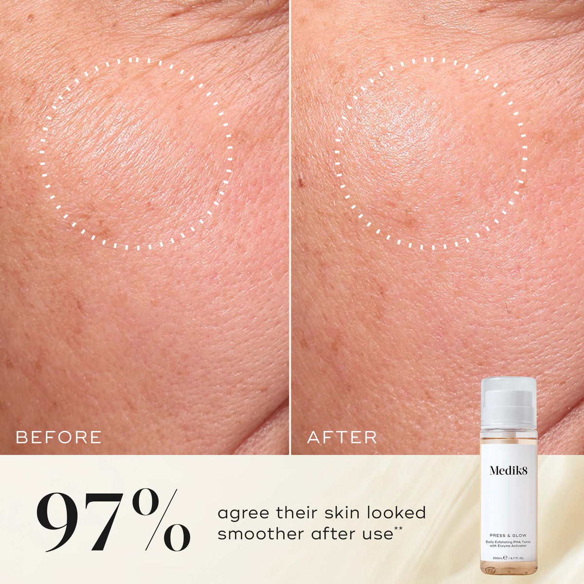 Medik8 Press & Glow Travel Size before and after results