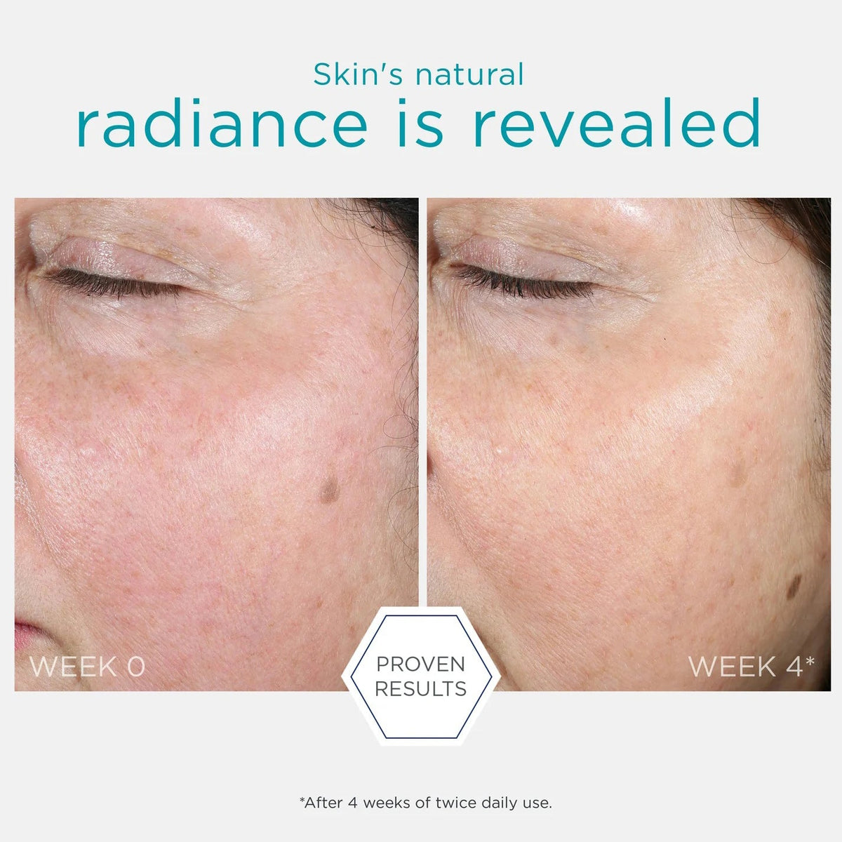 Neostrata Restore PHA Renewal Pads results after 1 and 2 weeks