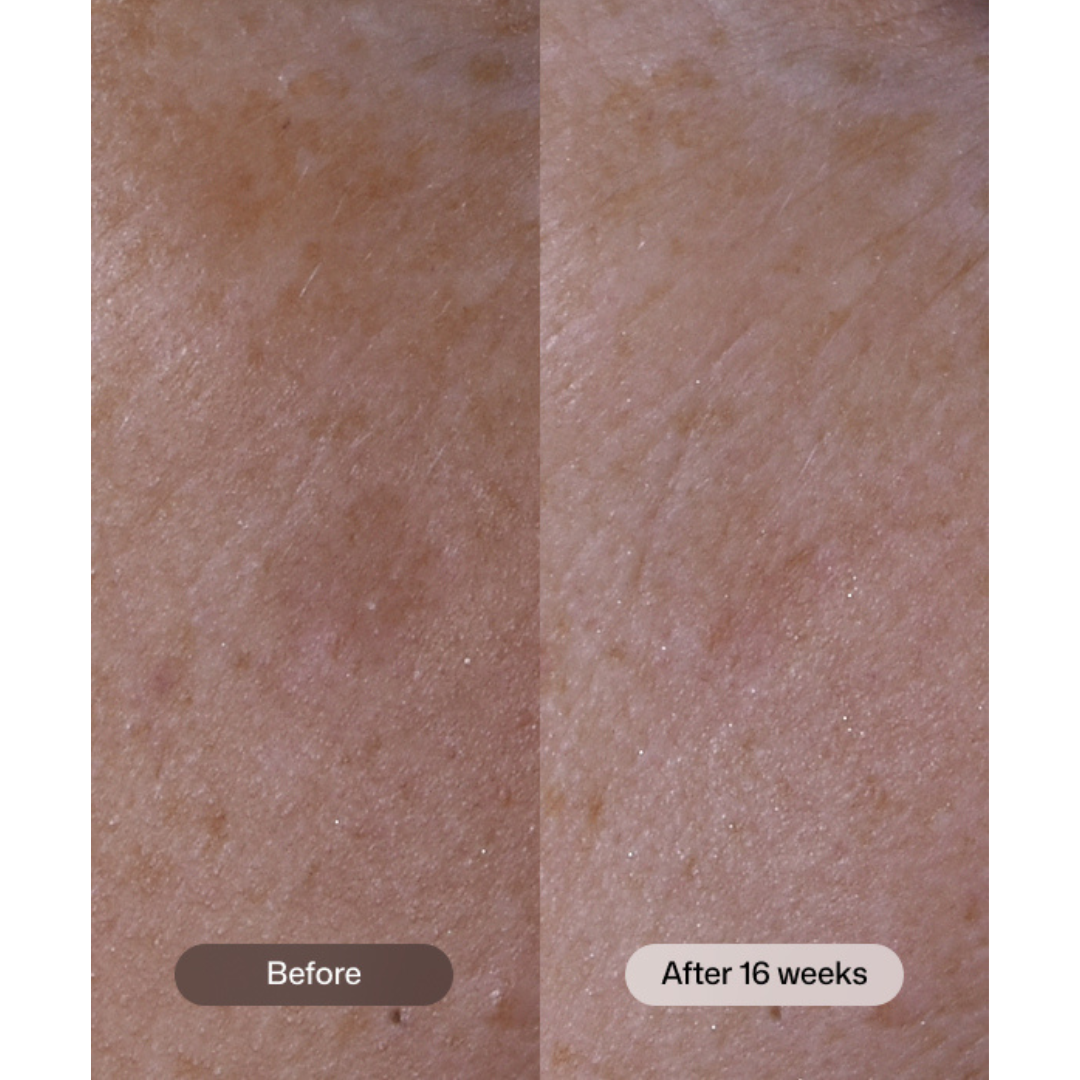 Revision Skincare Advanced Pigment Corrector+ Exosomal Signaling Technology explained