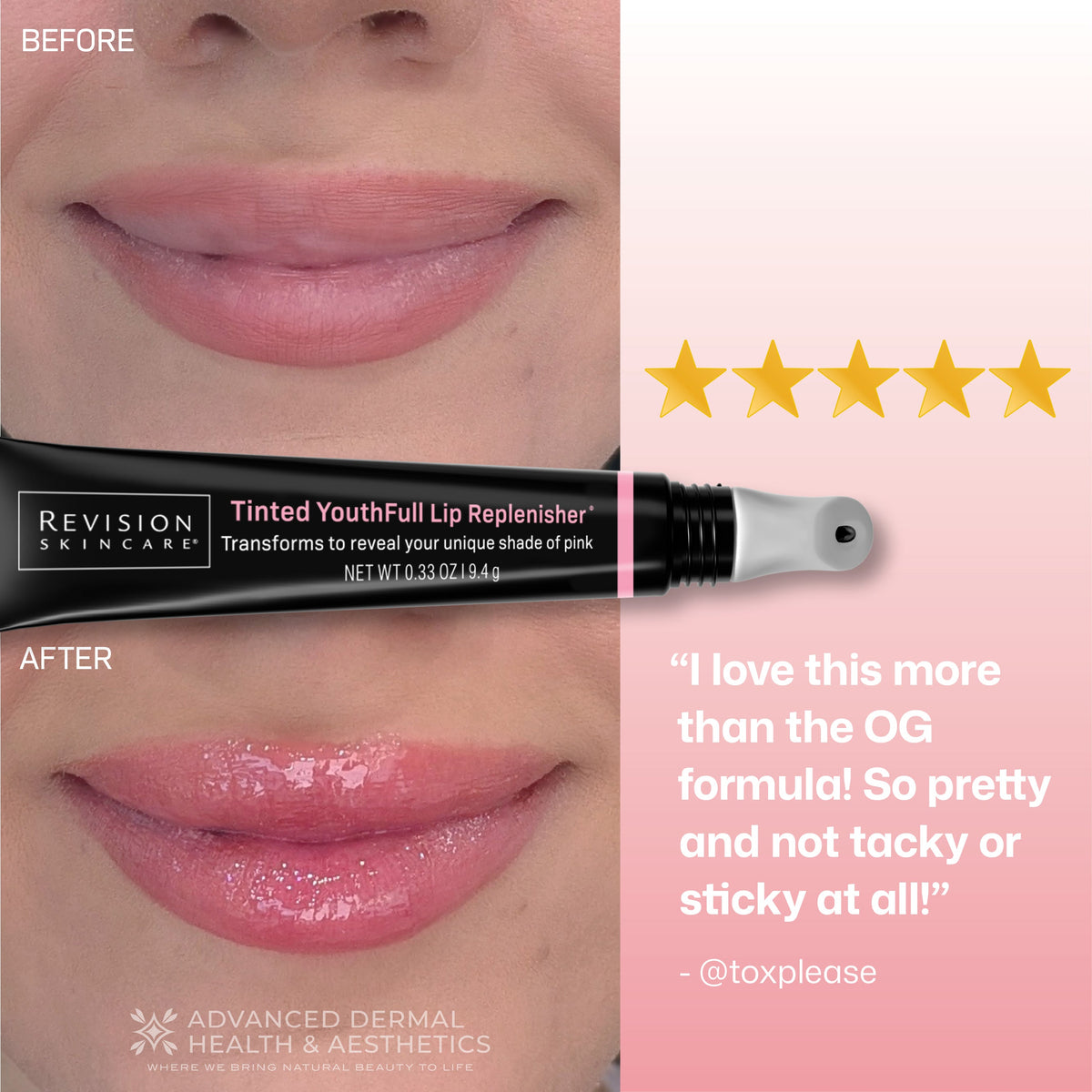 Revision Skincare Tinted YouthFull Lip Replenisher five-star customer reviews