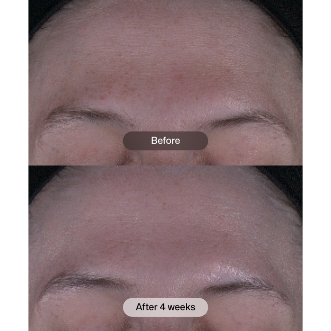 Revision Skincare Tone+ Correcting Pads dual-sided pad, smooth and textured sides