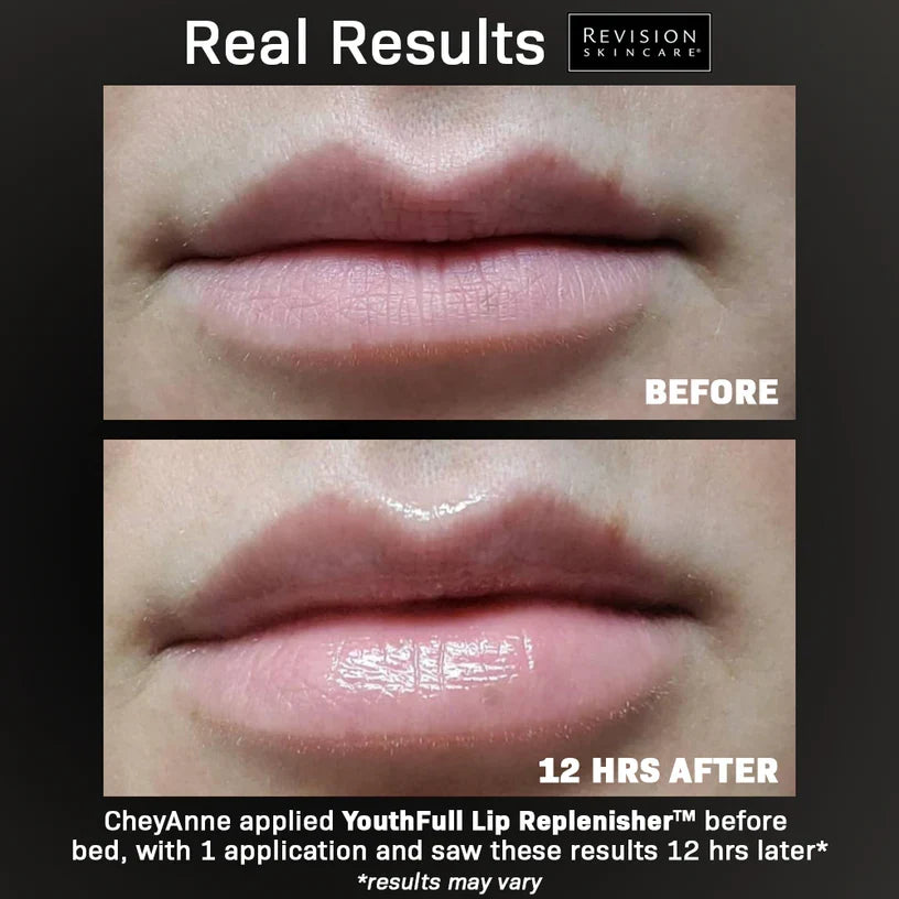 Revision Skincare YouthFull Lip Replenisher 2 Pack before and after showing fuller-looking lips