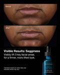 Before and after results using SkinCeuticals A.G.E. Interrupter Ultra Serum showing improved firmness and lift.