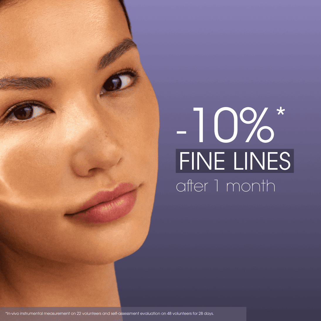 Teoxane R Advanced Serum results -10% fine lines after one month