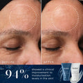 Before and after results showing 94% improvement in skin moisturisation with Medik8 H.E.O. Mask™.