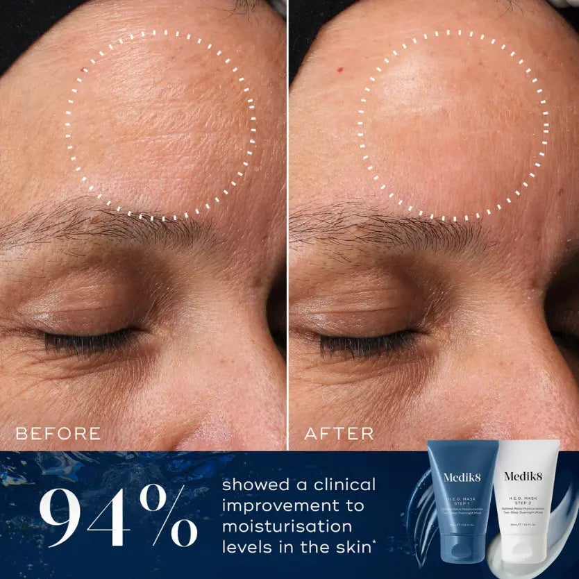 Before and after results showing 94% improvement in skin moisturisation with Medik8 H.E.O. Mask™.