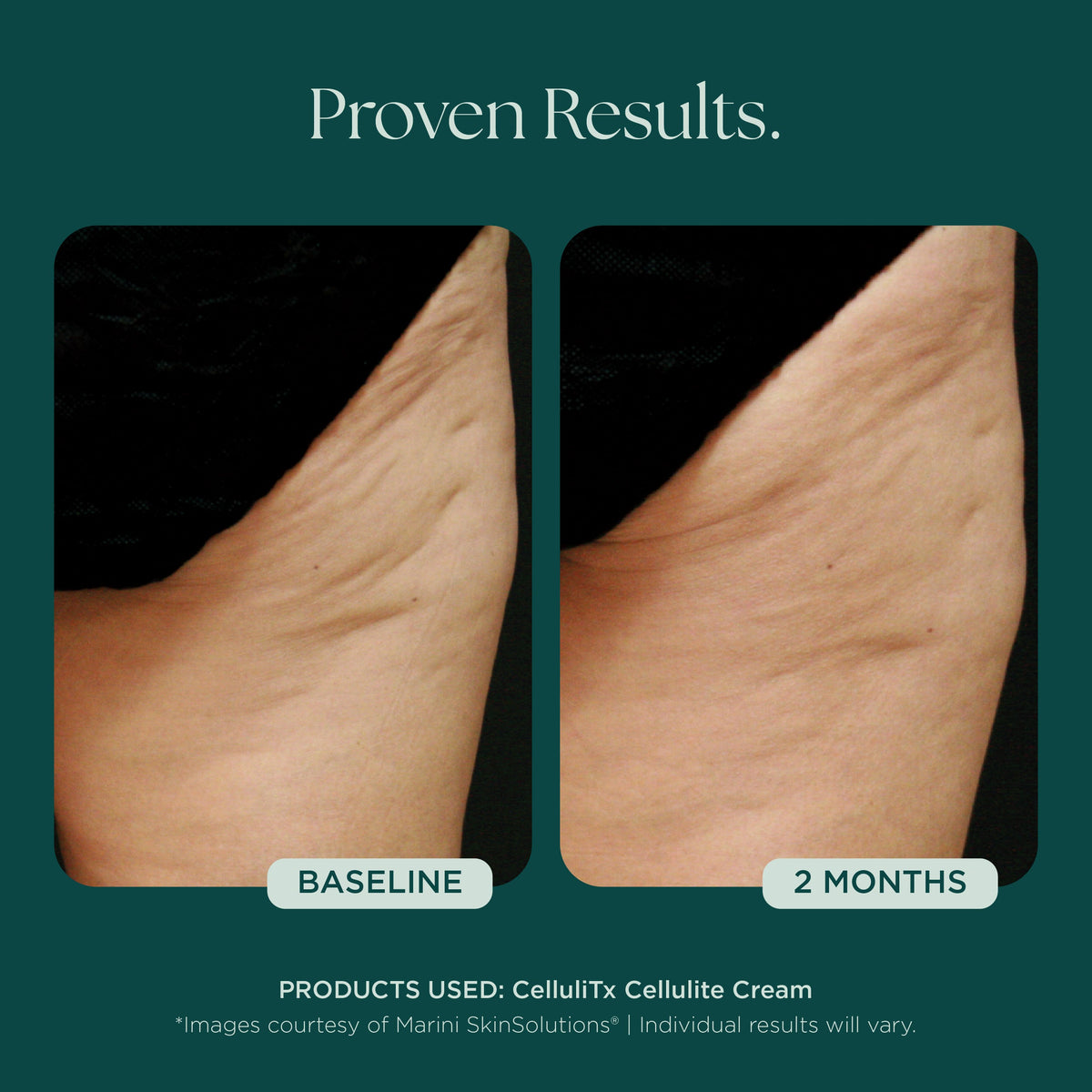 Marini SkinSolutions CelluliTx Cellulite Cream - before and after, texture