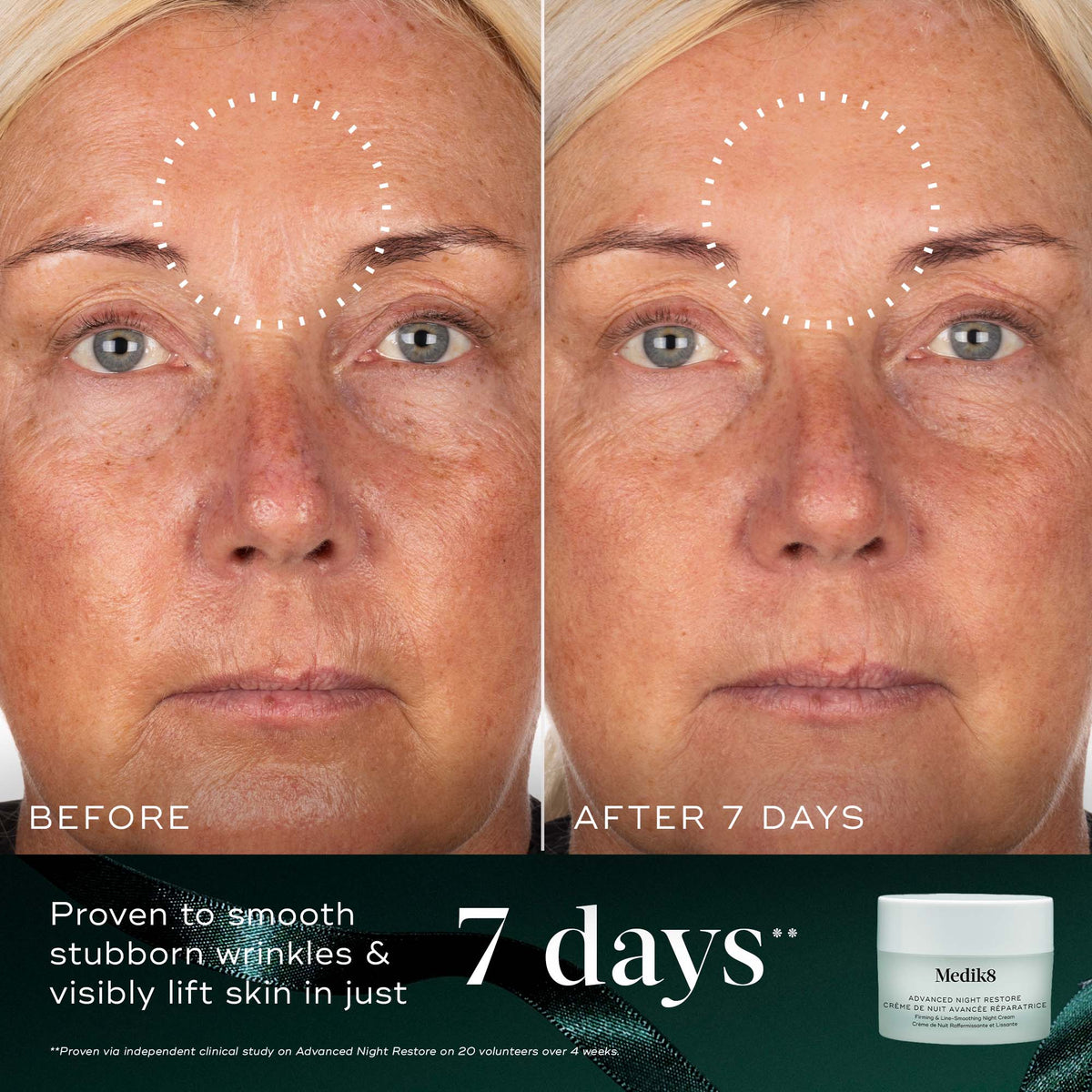 Medik8 Nighttime Nourish Advanced Night Restore before and after smoother skin at 7 days