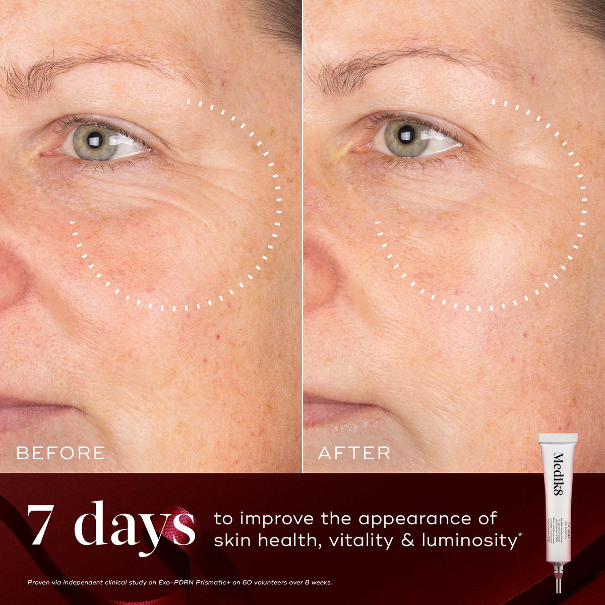 Medik8 Rejuvenation Routine Exo-PDRN Prismatic+ before and after luminosity results at 7 days