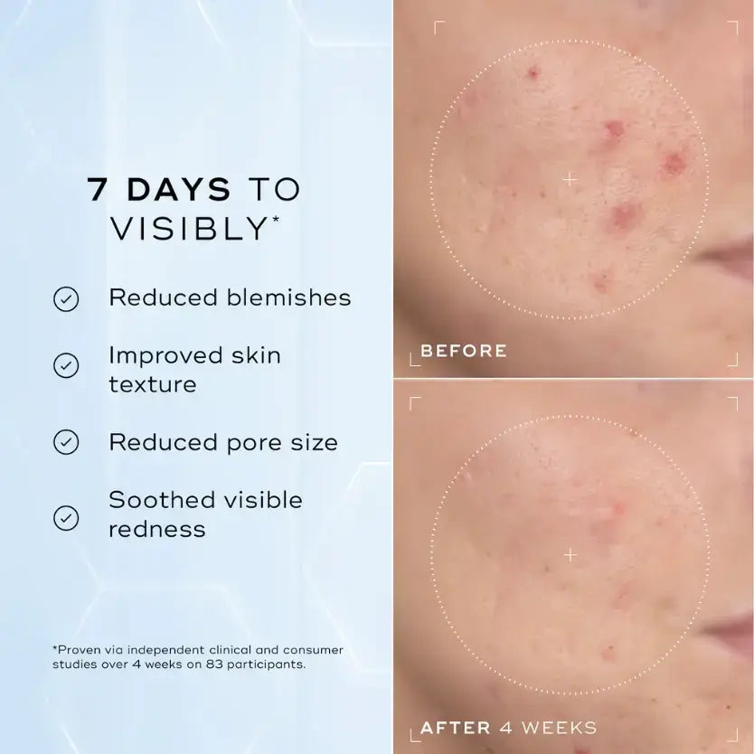 Image showing before and after results of Medik8™ Niacinamide Peptides, highlighting reduced blemishes and improved skin texture.
