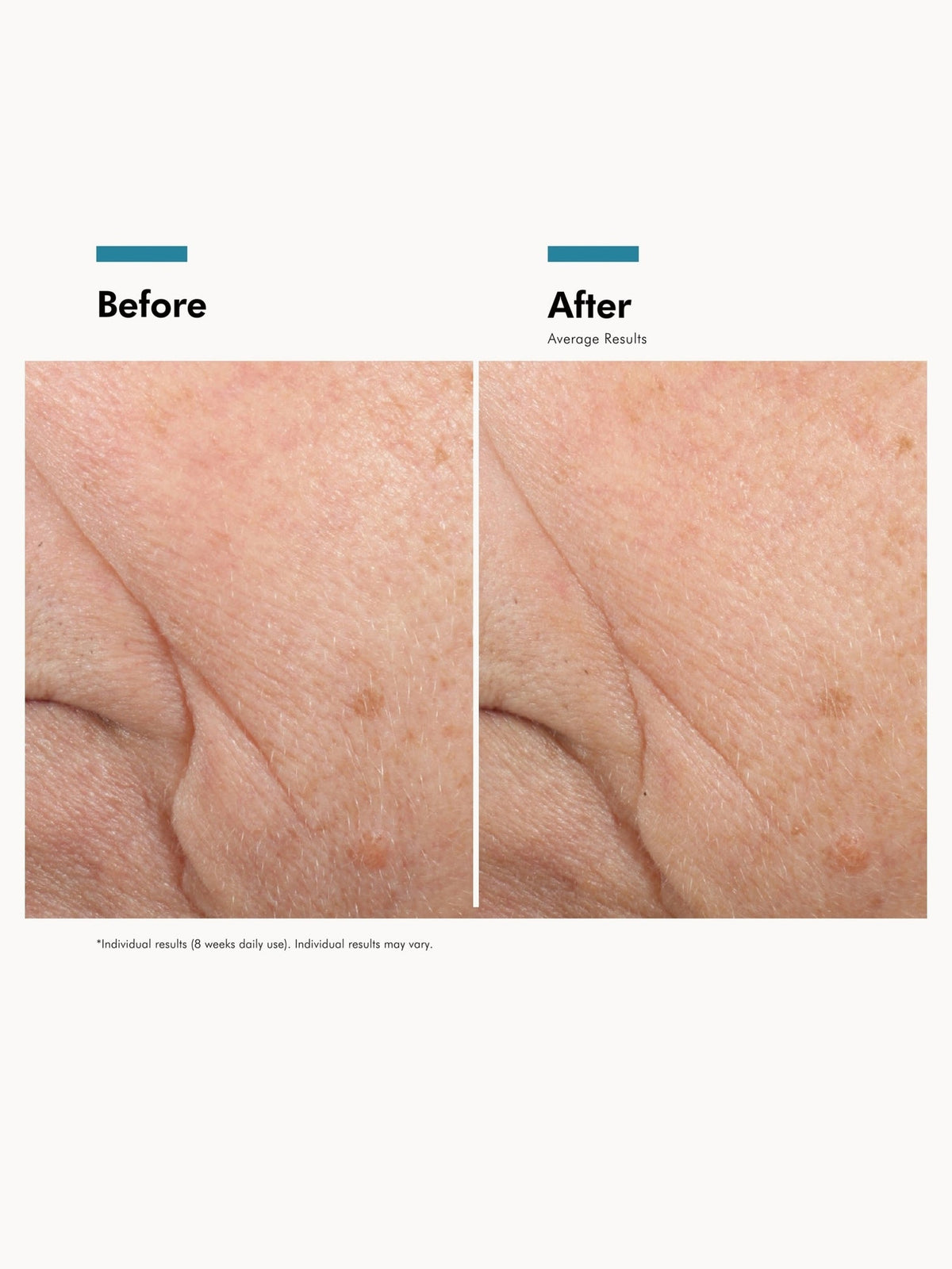 SkinCeuticals Triple Lipid Restore 2:4:2 before and after skin appearance