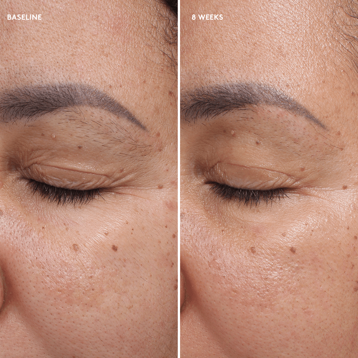 Colorescience Total Eye Firm & Repair Cream before and after 8 weeks of twice-daily use