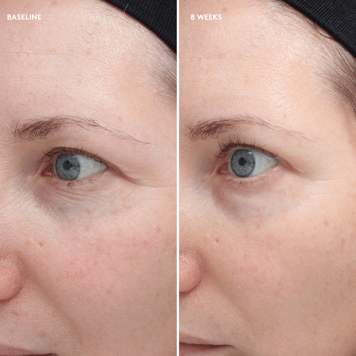 Colorescience Total Eye Firm & Repair Cream before and after 8 weeks, eye area