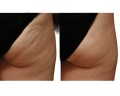 Jan Marini CelluliTx Cellulite Cream