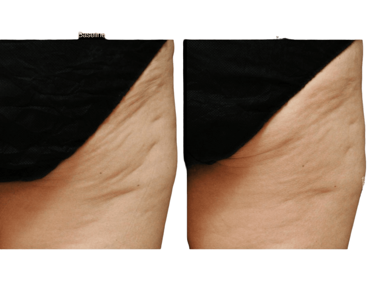 Jan Marini CelluliTx Cellulite Cream